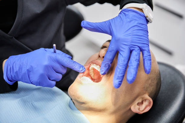 Best Emergency Gum Treatment in East Village, CT